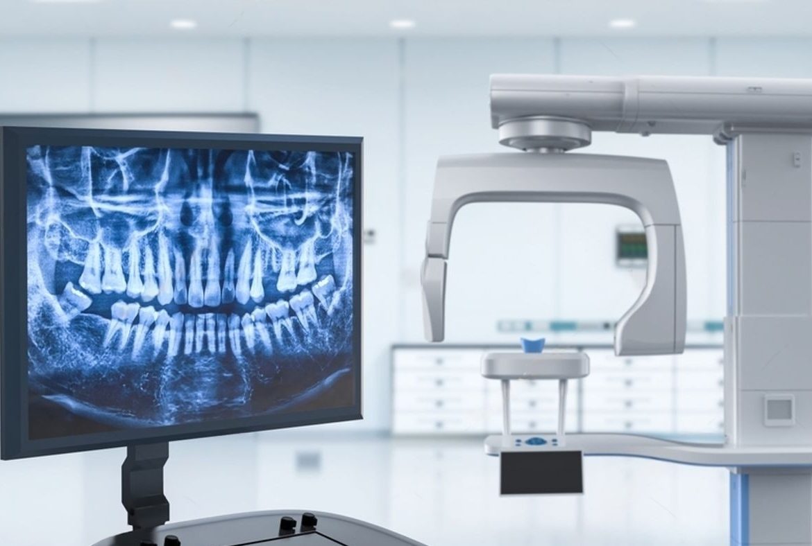 stock-photo--d-rendering-digital-x-ray-film-on-monitor-with-scanner-machine-in-dental-office-2455016935-transformed